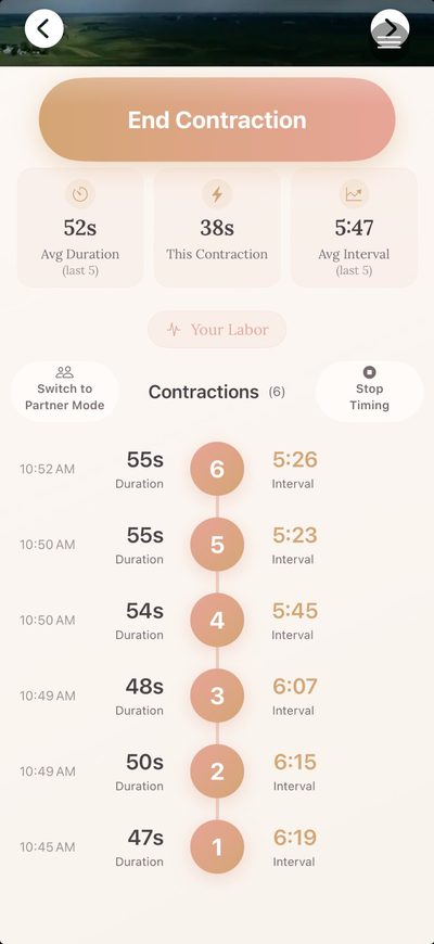 Contraction timeline