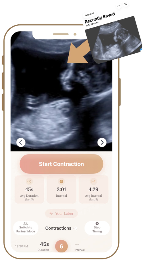 Your own ultrasound as a visual focus during labor